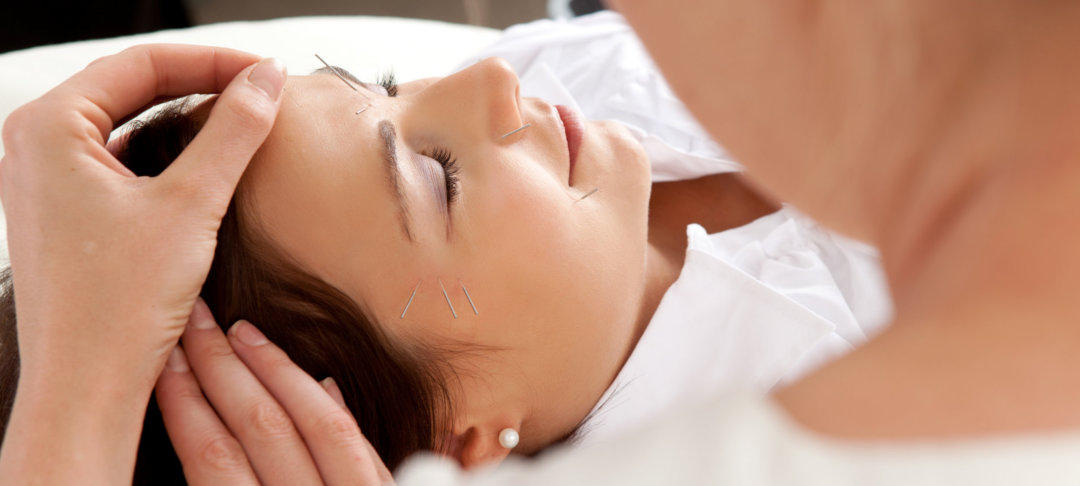 woman having a session acupuncture on her face