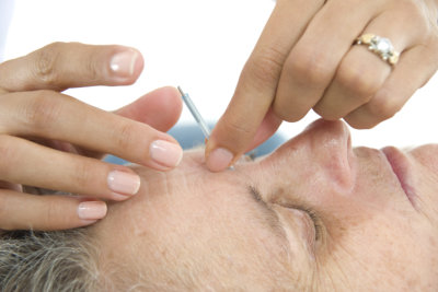 Application of needles in senior at the spa