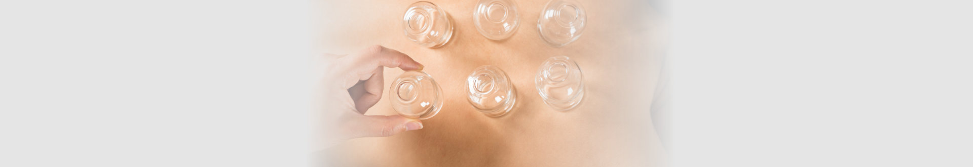 therapists hand is placing the cups on the woman back