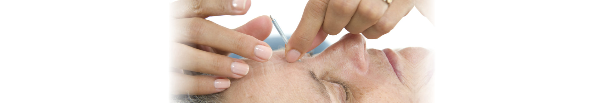 Application of needles in senior at the spa