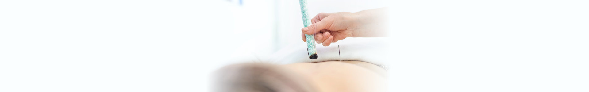 Woman being treated with acupuncture and moxibustion treatments